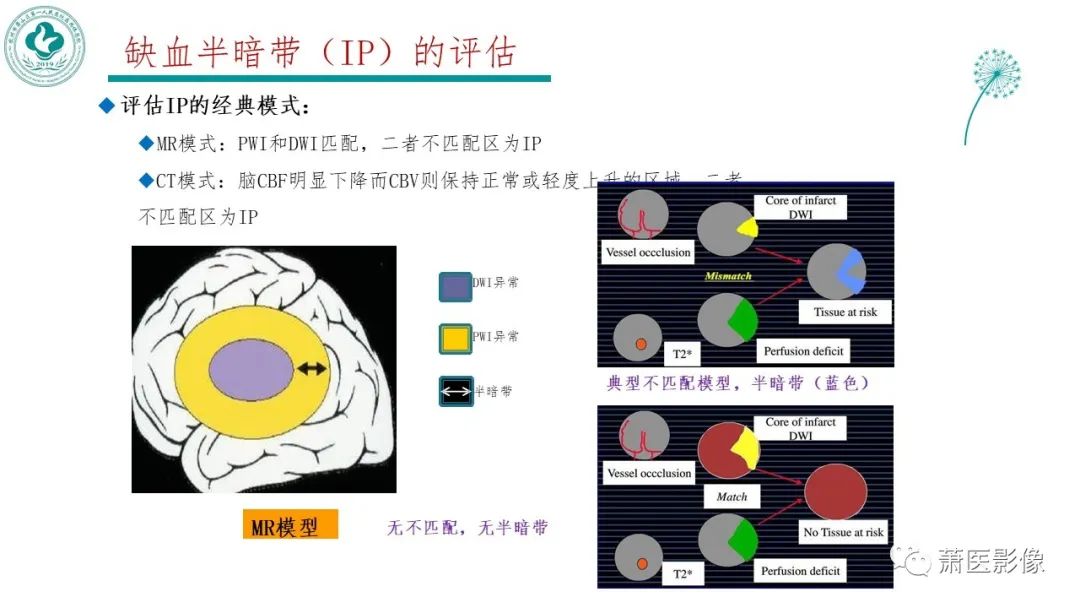 【PPT】脑灌注成像原理及在临床中的应用-25