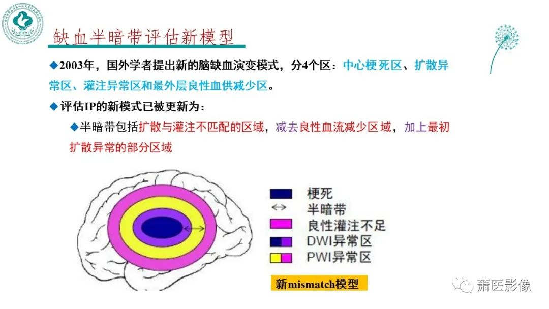 【PPT】脑灌注成像原理及在临床中的应用-30