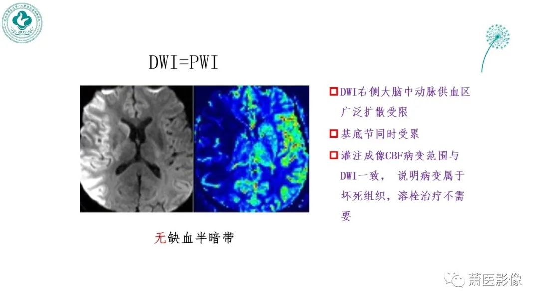【PPT】脑灌注成像原理及在临床中的应用-37