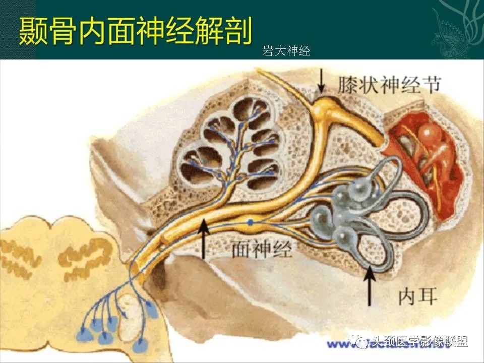 【PPT】耳部常见疾病影像表现-13