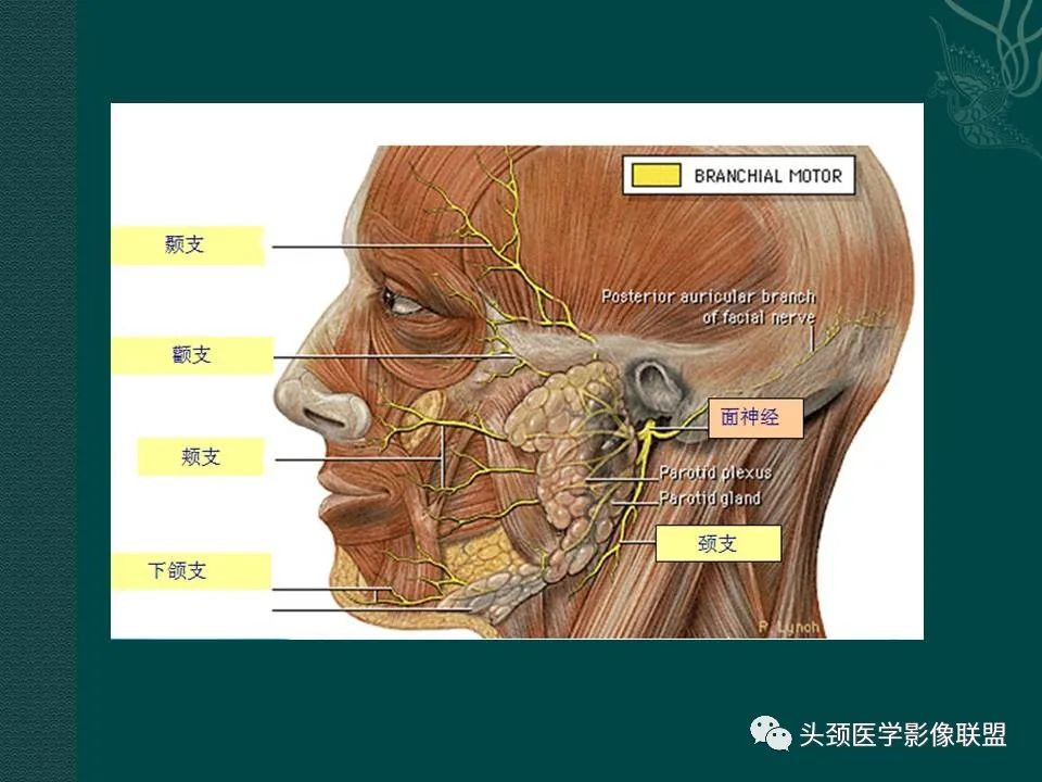 【PPT】耳部常见疾病影像表现-15