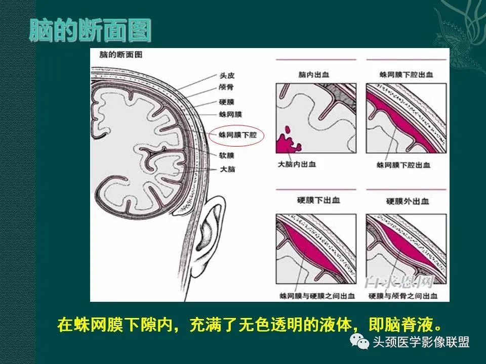 【PPT】耳部常见疾病影像表现-23