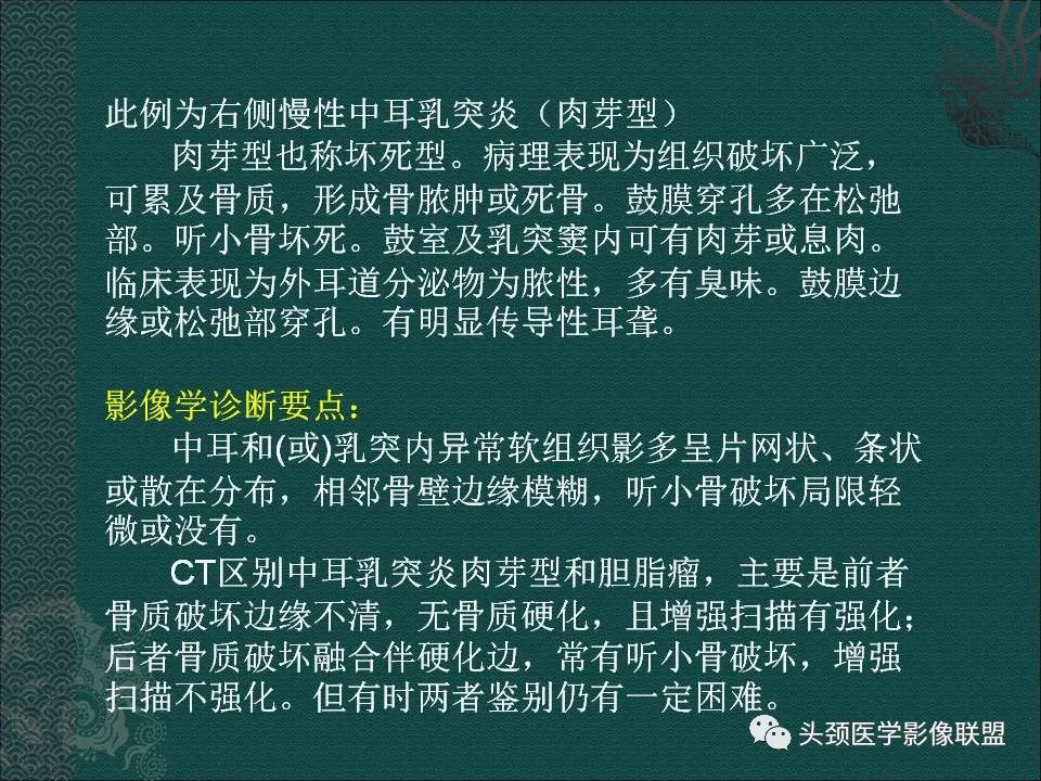 【PPT】耳部常见疾病影像表现-39