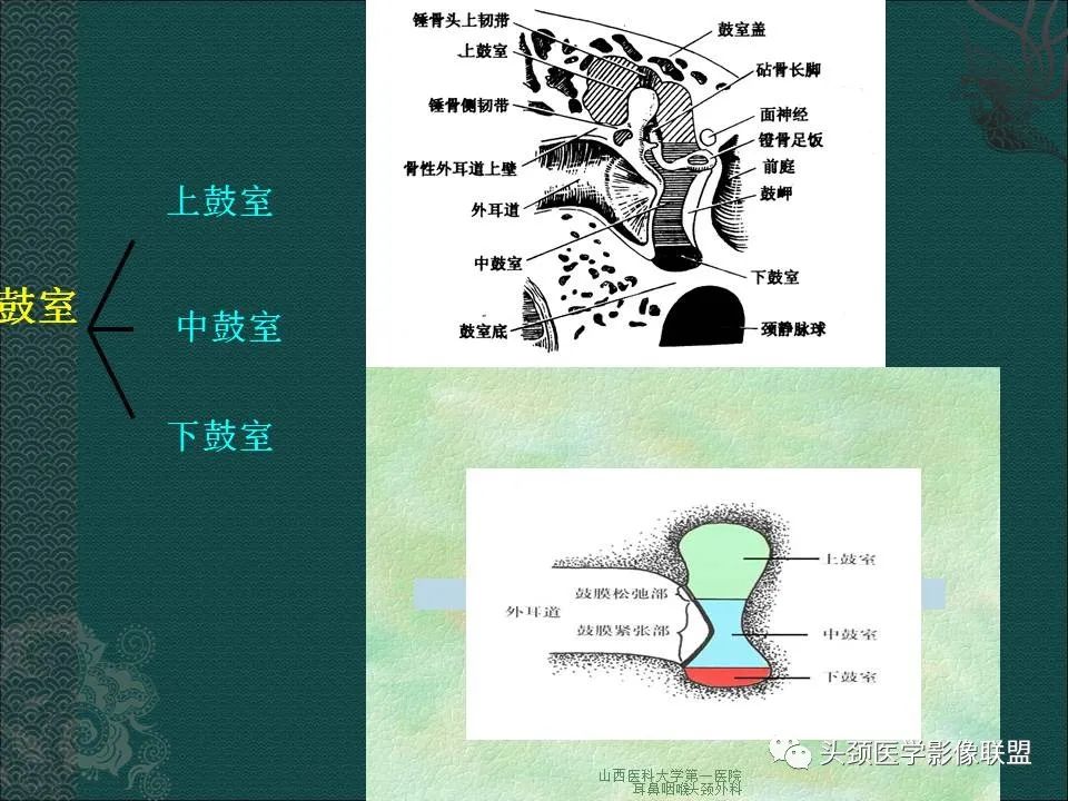 【PPT】耳部常见疾病影像表现-42