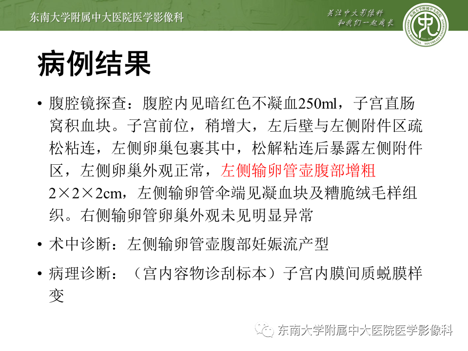 【PPT】常见妇科急腹症的超声-放射诊断-4