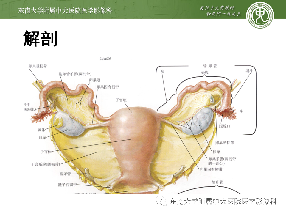 【PPT】常见妇科急腹症的超声-放射诊断-8