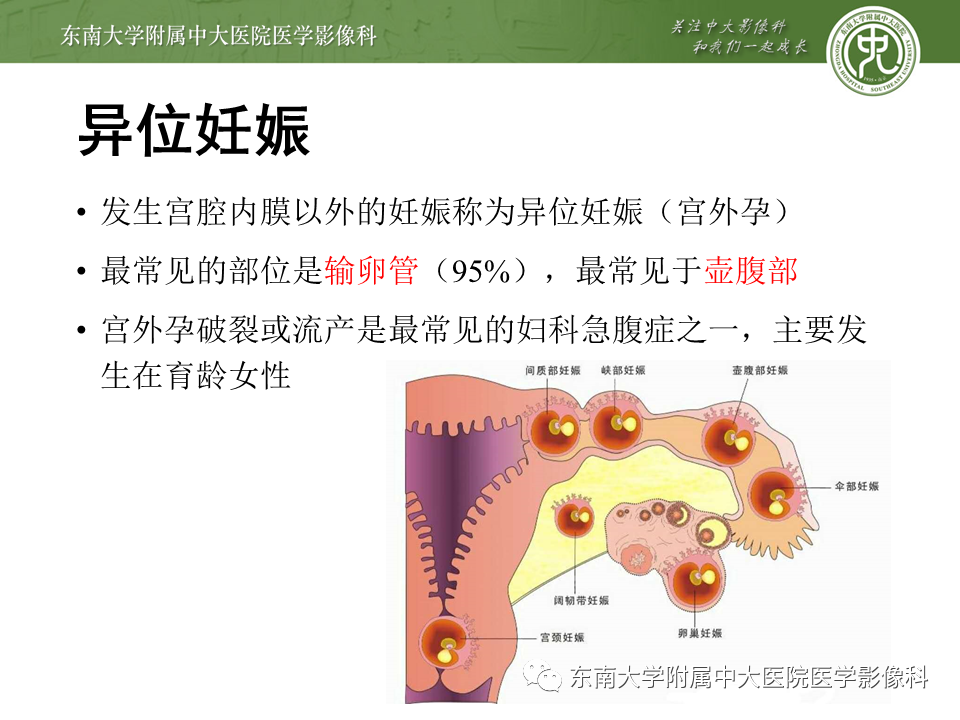 【PPT】常见妇科急腹症的超声-放射诊断-9