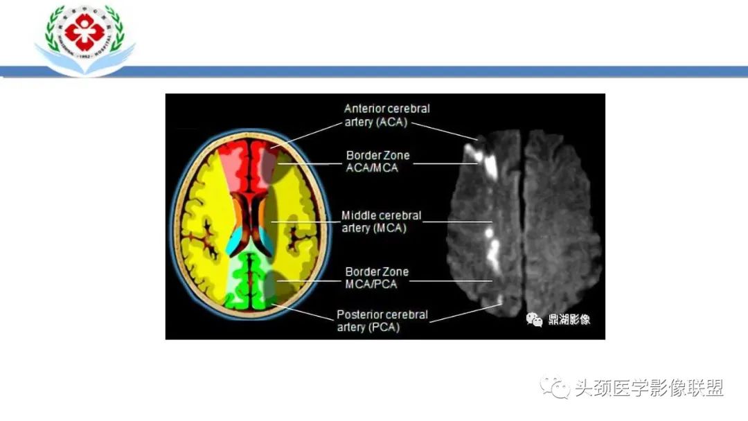 【PPT】特鲁索综合征-24