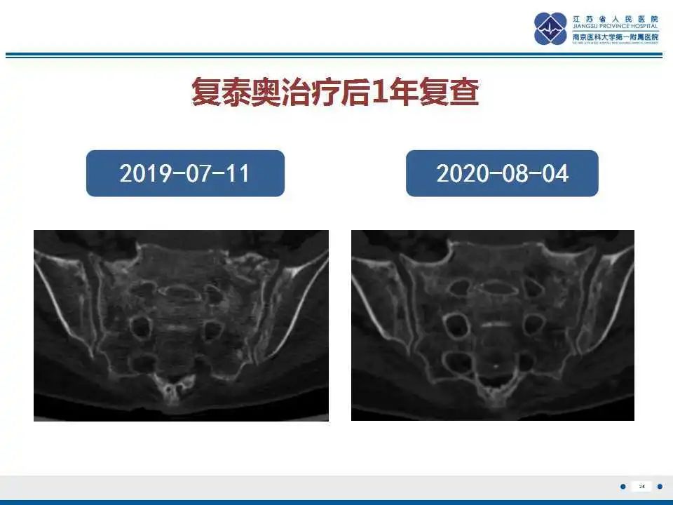 【PPT】骶骨机能不全骨折-26