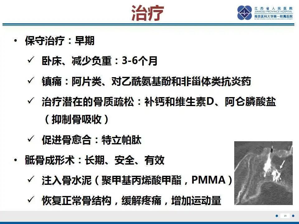 【PPT】骶骨机能不全骨折-25