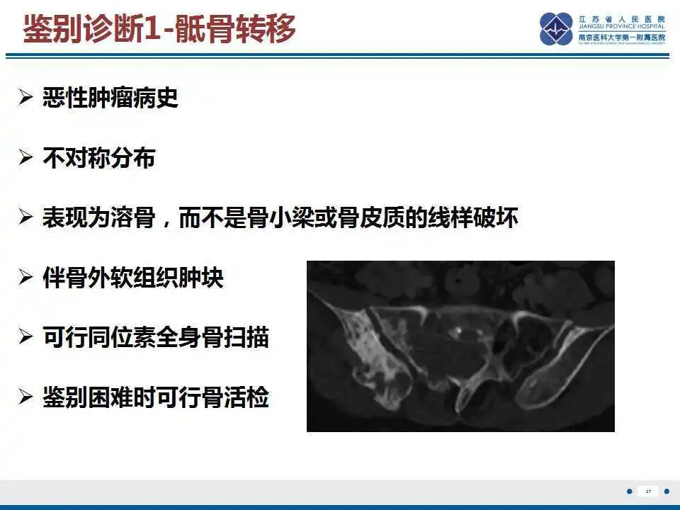 【PPT】骶骨机能不全骨折-28