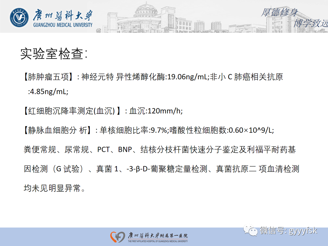 【病例】隐源性机化性肺炎1例CT影像-3