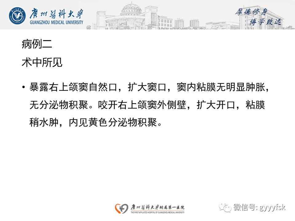 【病例】成釉细胞瘤 VS 牙源性囊肿-13