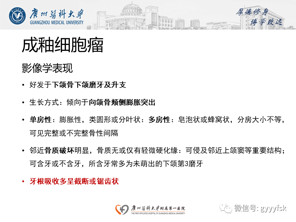 【病例】成釉细胞瘤 VS 牙源性囊肿-17