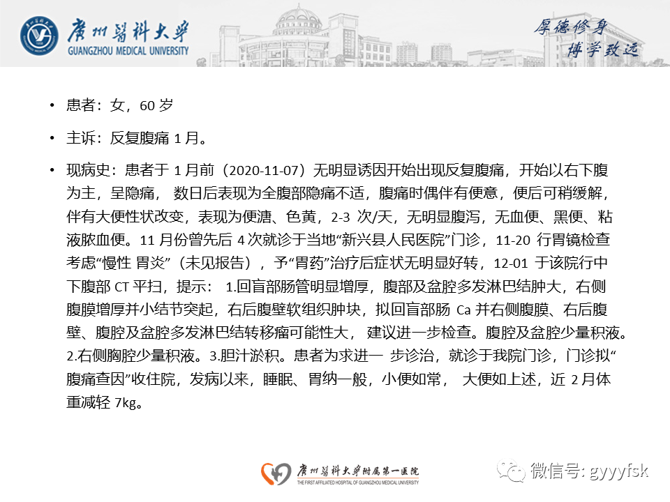 【病例】胃肠道淋巴瘤1例CT影像-2