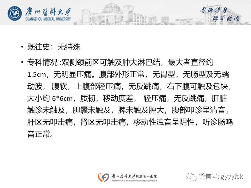 【病例】胃肠道淋巴瘤1例CT影像-3