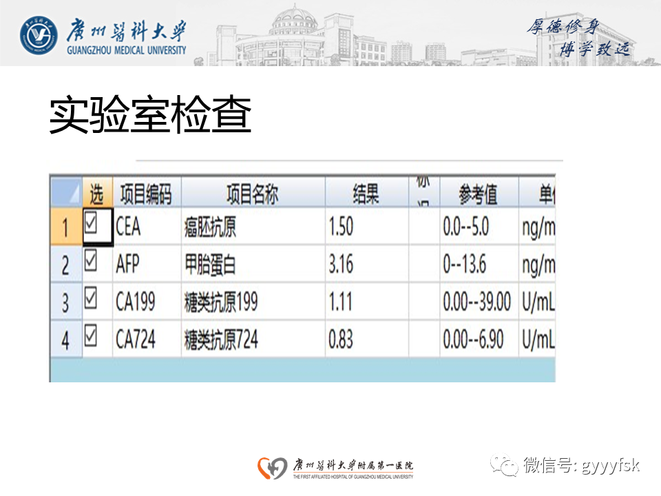 【病例】胃肠道淋巴瘤1例CT影像-4