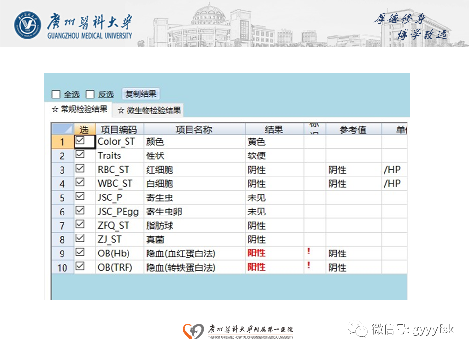 【病例】胃肠道淋巴瘤1例CT影像-5