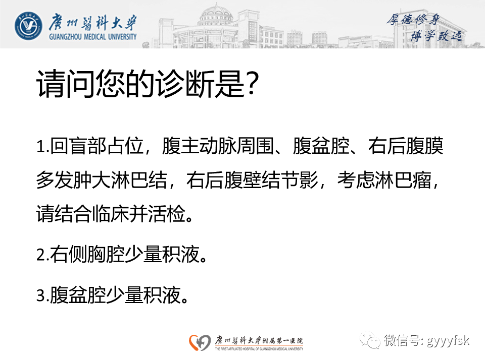 【病例】胃肠道淋巴瘤1例CT影像-10