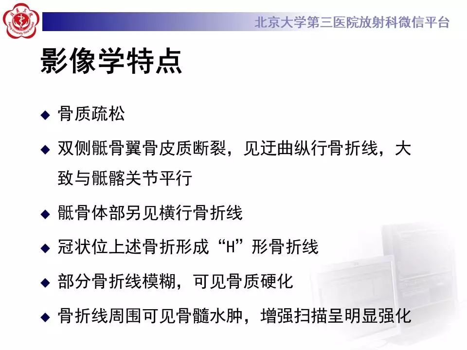 【PPT】骶骨不全骨折-9