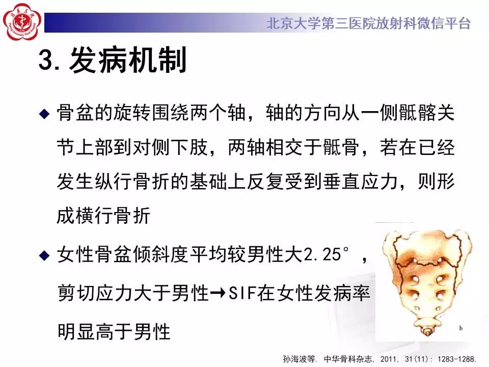 【PPT】骶骨不全骨折-15