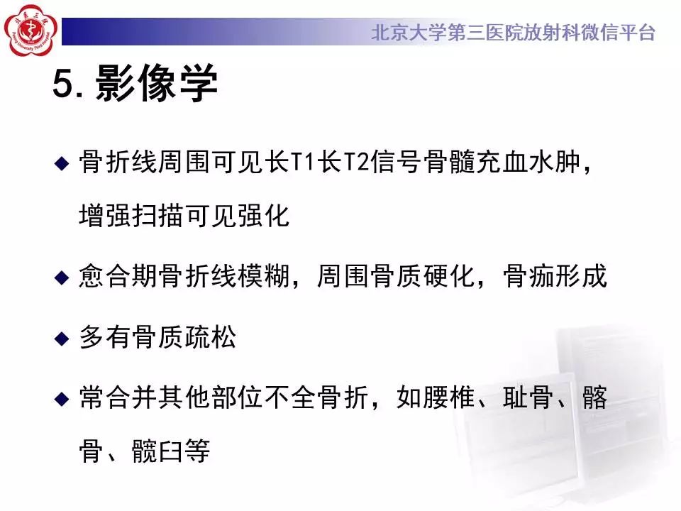 【PPT】骶骨不全骨折-18