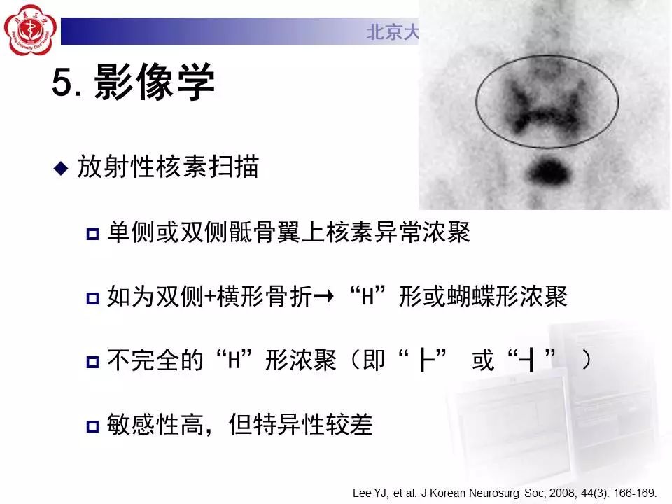 【PPT】骶骨不全骨折-19
