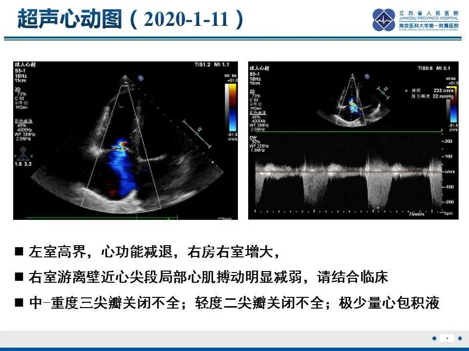 【PPT】直背综合征-5