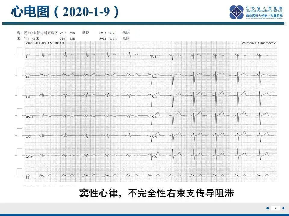 【PPT】直背综合征-3