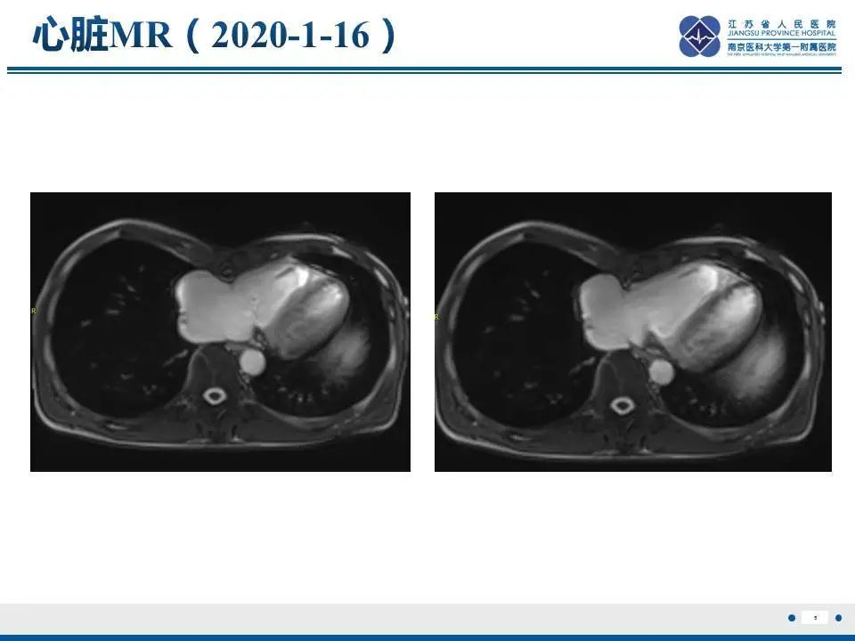 【PPT】直背综合征-6
