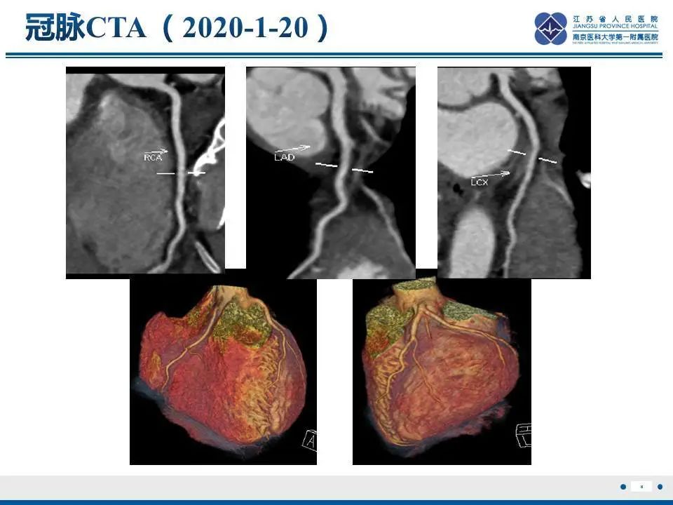 【PPT】直背综合征-9