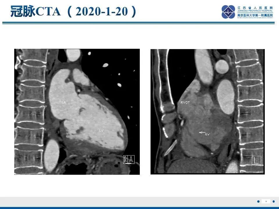 【PPT】直背综合征-10