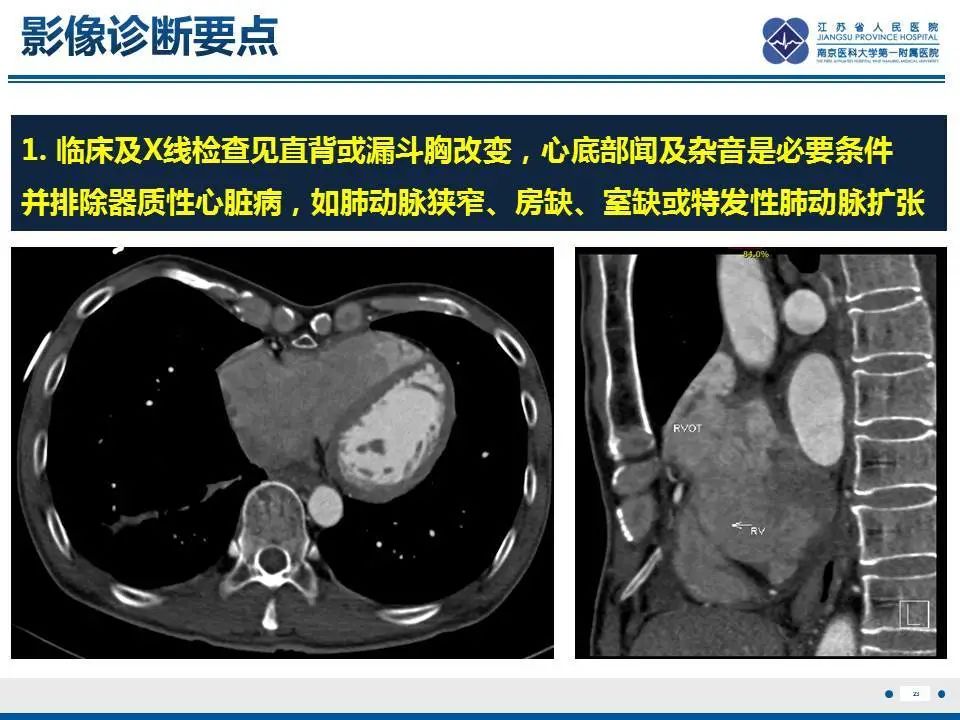 【PPT】直背综合征-24