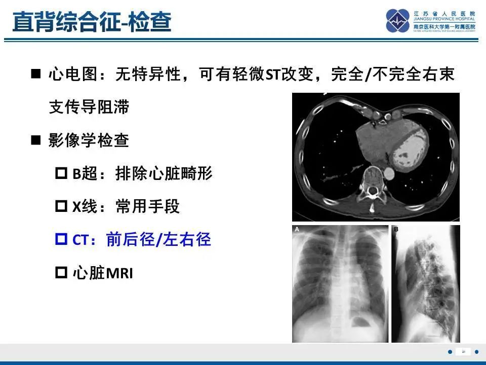 【PPT】直背综合征-22