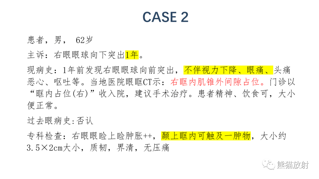 【PPT】泪腺多形性腺瘤 VS 眼眶淋巴瘤-7