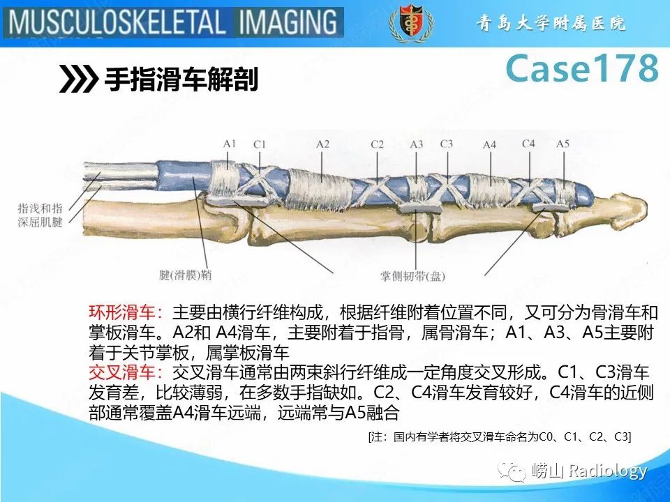 【PPT】手指滑车损伤-13