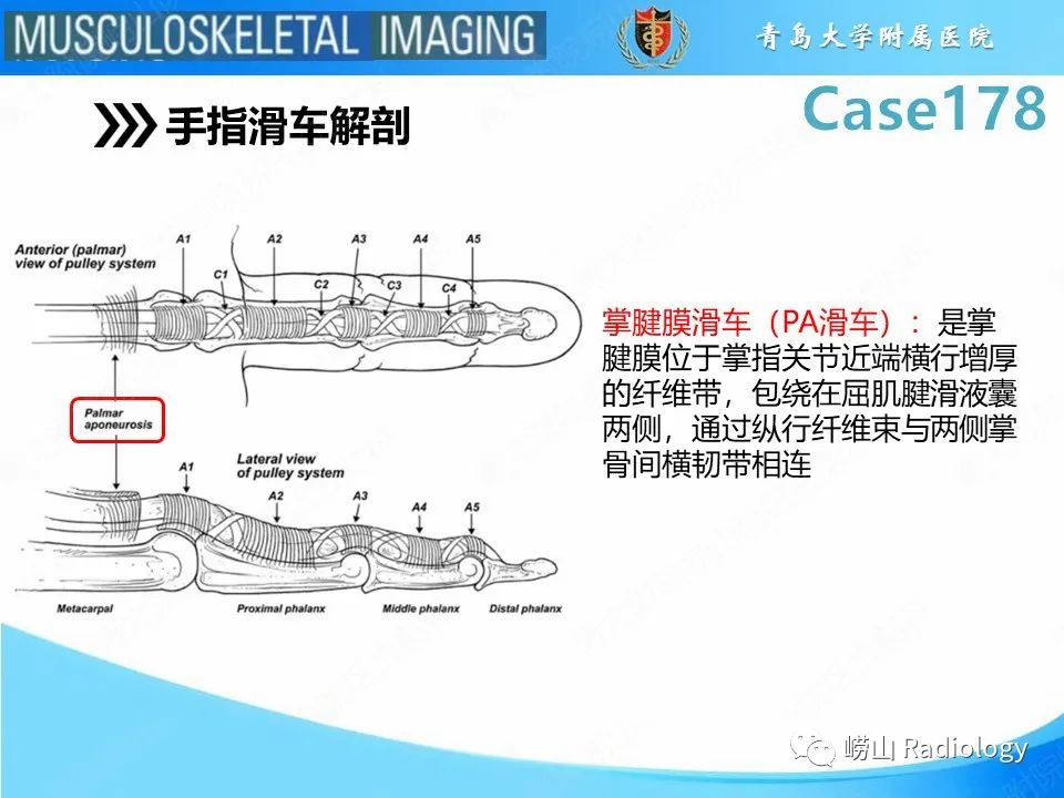 【PPT】手指滑车损伤-14