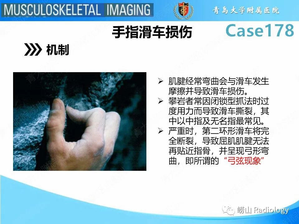 【PPT】手指滑车损伤-15