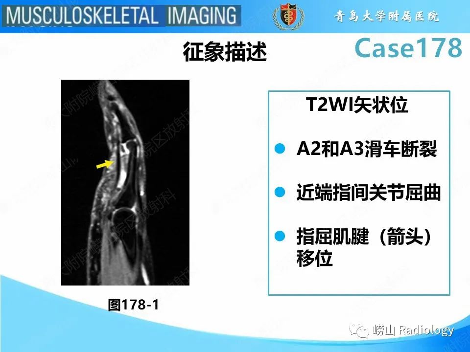 【PPT】手指滑车损伤-18