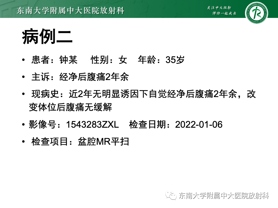 【PPT】子宫内膜异位症-17