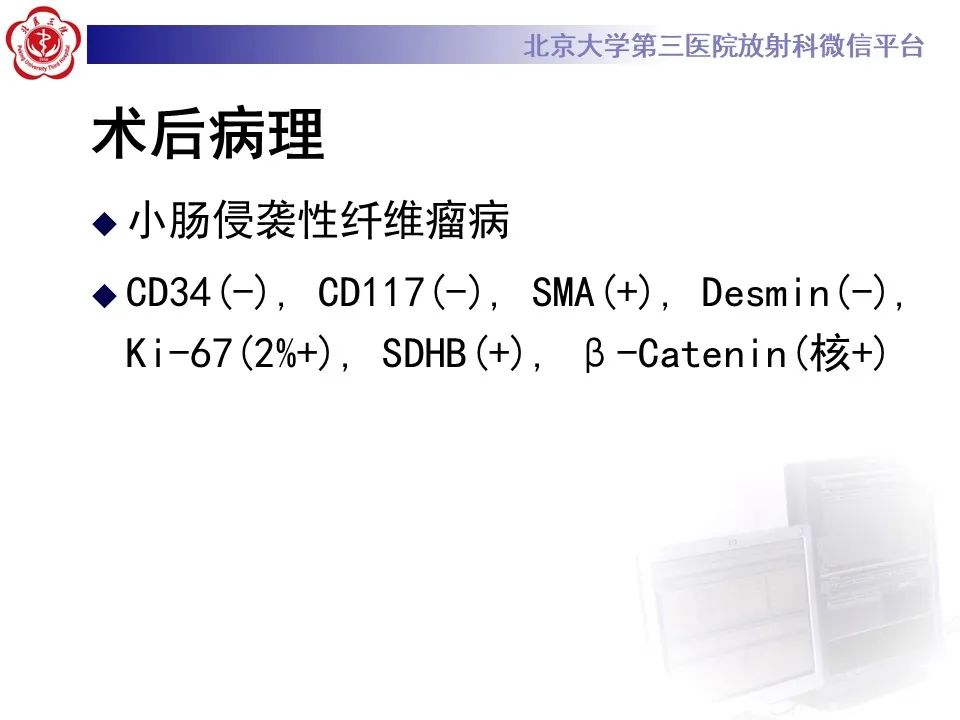 【PPT】侵袭性纤维瘤病（腹内型）-10