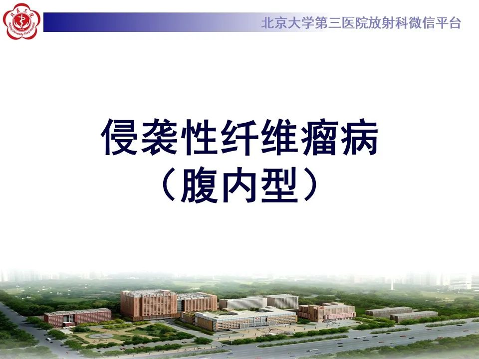 【PPT】侵袭性纤维瘤病（腹内型）-11