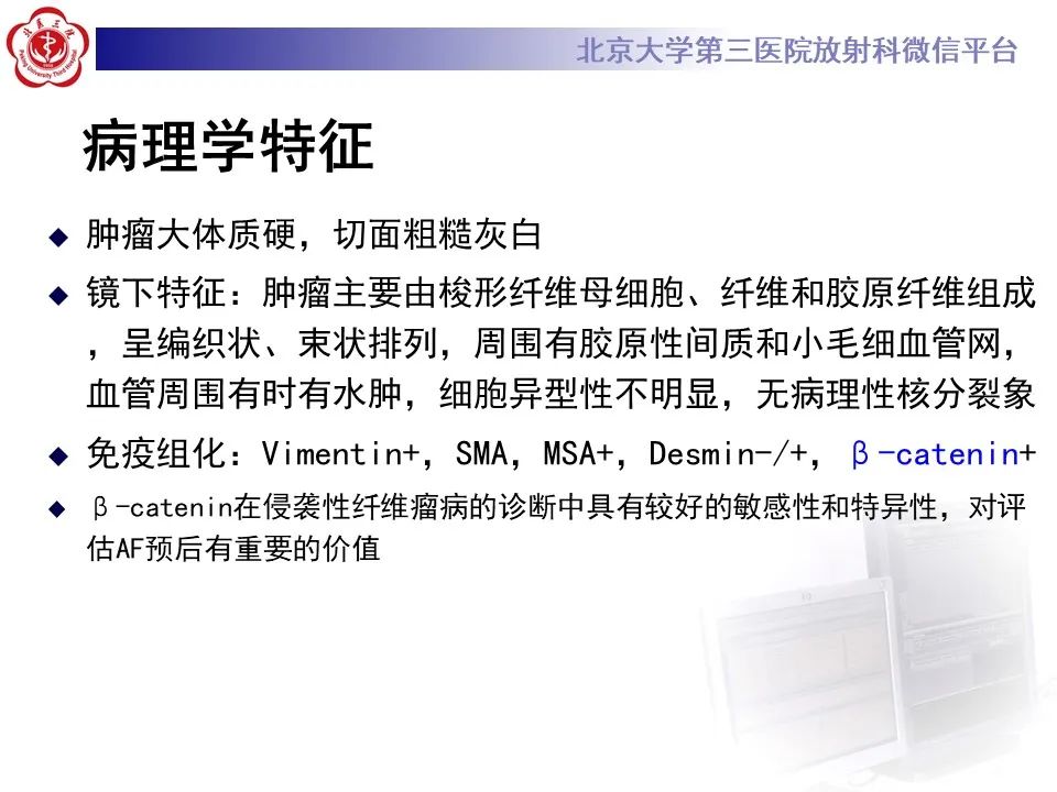 【PPT】侵袭性纤维瘤病（腹内型）-15