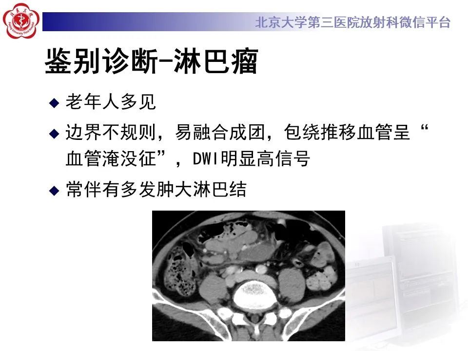 【PPT】侵袭性纤维瘤病（腹内型）-24