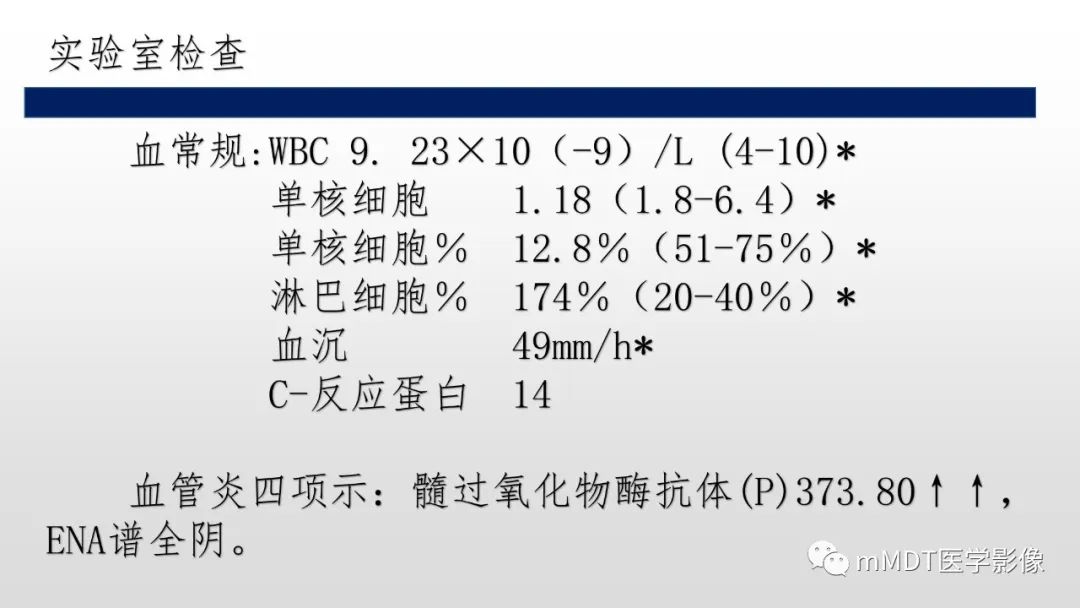 【PPT】神经白塞病NBD-3