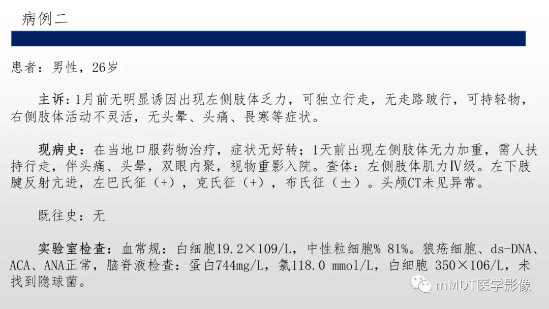 【PPT】神经白塞病NBD-13