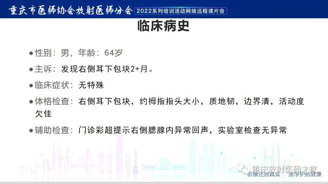 【病例】腮腺腺淋巴瘤1例CT影像-2