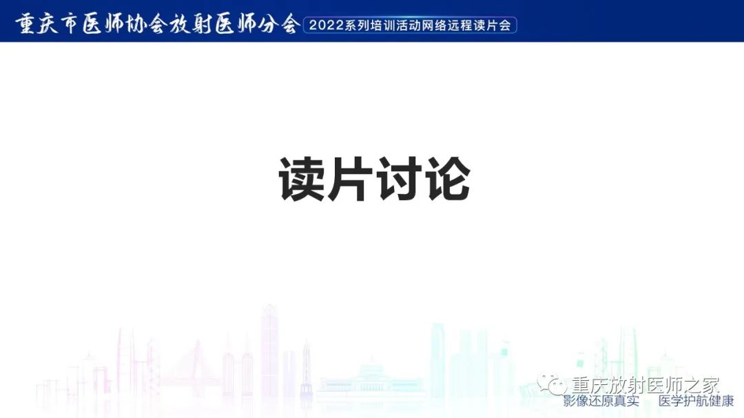 【病例】腮腺腺淋巴瘤1例CT影像-7