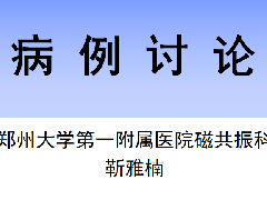 心尖肥厚型心肌病1例MR影像