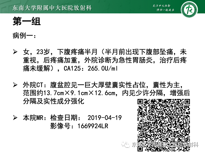 附件扭转4例病例随访